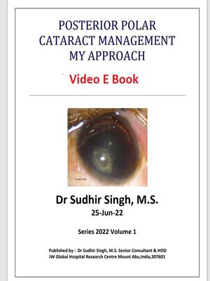 cover image of Posterior Polar Cataract Management